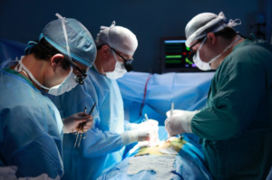 tummy tuck